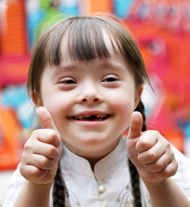 Illustration for article titled Scientists May Have Found a Genomic Off Switch for Down Syndrome